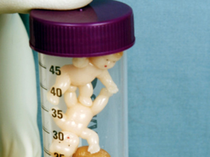 案例